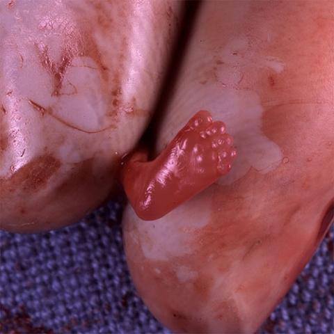 (C) Public Domain (Priests for Life)