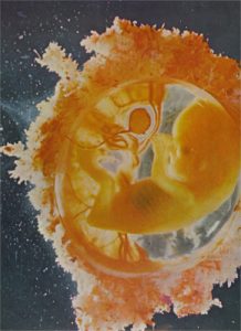 Embryo 11 Wochen